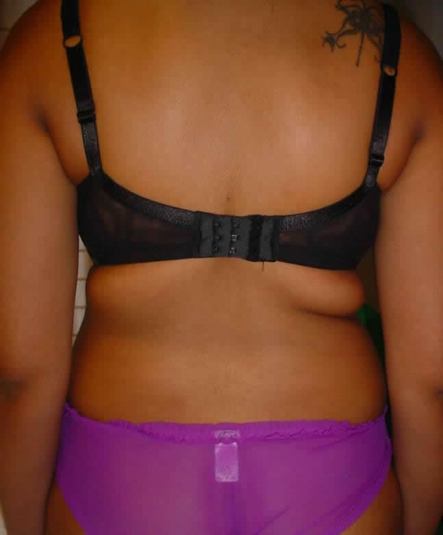 before ultrasound